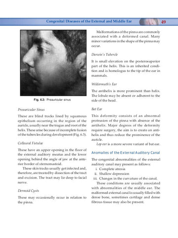 Catarrhal Steel Wire